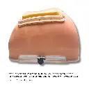 ventral-hernia-class-ii-2.webp