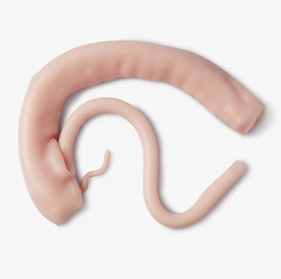 Right Hemicolectomy (Class II)