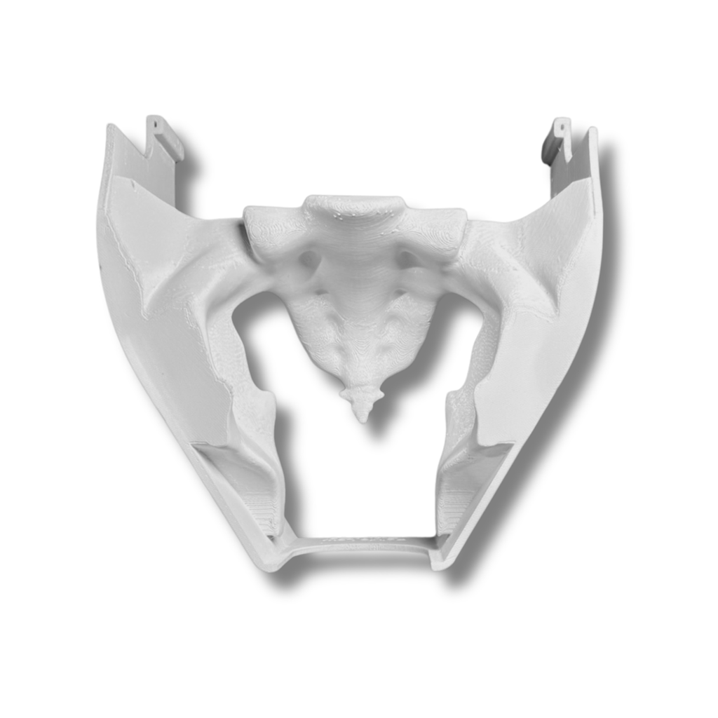 Male Pelvis (Class I)