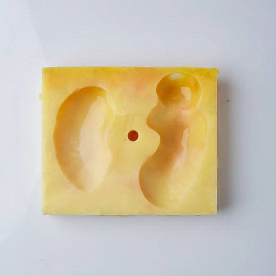 Partial Nephrectomy Fat Base (Class I)
