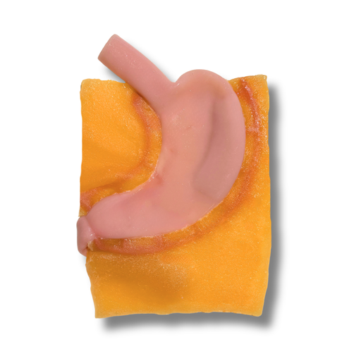[GENGASIII] Gastric (Class III)