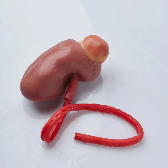 IMRA BioTissue Partial Nephrectomy Class II syntetisk treningsmodell