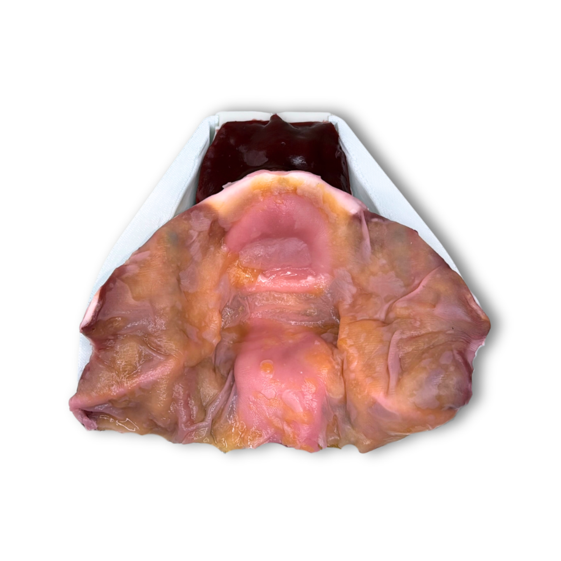 IMRA BioTissue Prostatectomy Class V syntetisk treningsmodell